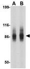 SP110 Nuclear Body Protein antibody, GTX85041, GeneTex, Western Blot image 