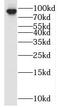 Oligophrenin 1 antibody, FNab05989, FineTest, Western Blot image 