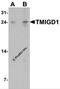 Transmembrane And Immunoglobulin Domain Containing 1 antibody, 7615, ProSci, Western Blot image 