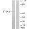 STEAP3 Metalloreductase antibody, A05568, Boster Biological Technology, Western Blot image 