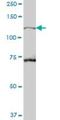 TBC1 domain family member 2A antibody, H00055357-B01P, Novus Biologicals, Western Blot image 