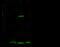 Galectin 7B antibody, GTX02261, GeneTex, Western Blot image 