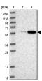 BUD13 Homolog antibody, PA5-58351, Invitrogen Antibodies, Western Blot image 