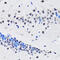 RuvB Like AAA ATPase 2 antibody, 18-374, ProSci, Immunohistochemistry paraffin image 