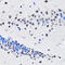 RuvB-like 2 antibody, 18-374, ProSci, Immunohistochemistry paraffin image 