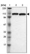 Ubiquitin Specific Peptidase 33 antibody, NBP1-82931, Novus Biologicals, Western Blot image 
