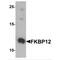 FKBP Prolyl Isomerase 1A antibody, MBS153690, MyBioSource, Western Blot image 