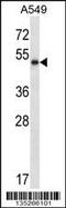 Pancreatic Lipase antibody, 58-220, ProSci, Western Blot image 