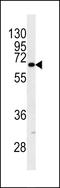 Keratin-9 antibody, LS-C100897, Lifespan Biosciences, Western Blot image 