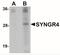 Synaptogyrin 4 antibody, NBP1-77103, Novus Biologicals, Western Blot image 