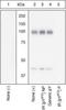 Insulin Receptor antibody, GTX25678, GeneTex, Western Blot image 