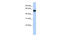 Retinoid X Receptor Alpha antibody, 25-180, ProSci, Enzyme Linked Immunosorbent Assay image 