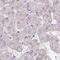 Rhophilin Associated Tail Protein 1 Like antibody, PA5-59746, Invitrogen Antibodies, Immunohistochemistry paraffin image 