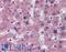 Hyaluronidase 1 antibody, LS-B3995, Lifespan Biosciences, Immunohistochemistry paraffin image 