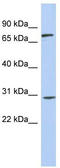 Zinc Finger Protein 131 antibody, TA342425, Origene, Western Blot image 