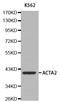 Actin Alpha 2, Smooth Muscle antibody, abx125488, Abbexa, Western Blot image 