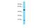 Keratin 25 antibody, A10101, Boster Biological Technology, Western Blot image 