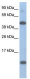 Ligand Dependent Nuclear Receptor Corepressor antibody, TA329596, Origene, Western Blot image 