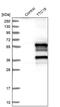 Tetratricopeptide Repeat Domain 19 antibody, PA5-54664, Invitrogen Antibodies, Western Blot image 
