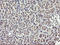 HRas Proto-Oncogene, GTPase antibody, LS-C174468, Lifespan Biosciences, Immunohistochemistry paraffin image 