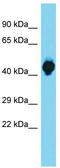 Somatostatin Receptor 1 antibody, TA342650, Origene, Western Blot image 