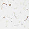 ATP Binding Cassette Subfamily B Member 1 antibody, LS-C749747, Lifespan Biosciences, Immunohistochemistry frozen image 