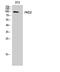 Protein Kinase D2 antibody, STJ95138, St John