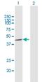 Casein Kinase 1 Alpha 1 Like antibody, H00122011-B03P, Novus Biologicals, Western Blot image 