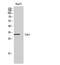 Cyclin Dependent Kinase 5 antibody, A00511-2, Boster Biological Technology, Western Blot image 