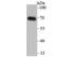 Sorting Nexin 1 antibody, A02692-1, Boster Biological Technology, Western Blot image 