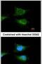 Glucosylceramidase Beta antibody, PA5-21347, Invitrogen Antibodies, Immunofluorescence image 