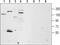 Transient receptor potential cation channel subfamily M member 4 antibody, PA5-77324, Invitrogen Antibodies, Western Blot image 