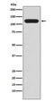 Mucin 4, Cell Surface Associated antibody, M01652-1, Boster Biological Technology, Western Blot image 