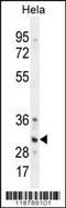 TNFRSF1A Associated Via Death Domain antibody, 56-146, ProSci, Western Blot image 