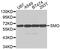 Smoothened, Frizzled Class Receptor antibody, abx005624, Abbexa, Western Blot image 