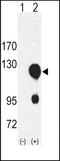 Receptor Tyrosine Kinase Like Orphan Receptor 2 antibody, TA324968, Origene, Western Blot image 