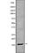 Cellular Retinoic Acid Binding Protein 1 antibody, abx149540, Abbexa, Western Blot image 