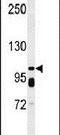 ATP Binding Cassette Subfamily C Member 11 antibody, PA5-24718, Invitrogen Antibodies, Western Blot image 