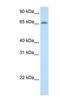 Adenosine Deaminase TRNA Specific 1 antibody, NBP1-57221, Novus Biologicals, Western Blot image 