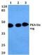 Protein Kinase CAMP-Dependent Type II Regulatory Subunit Alpha antibody, A03911, Boster Biological Technology, Western Blot image 