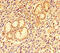 C-C motif chemokine 8 antibody, LS-C317955, Lifespan Biosciences, Immunohistochemistry paraffin image 