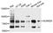 ADAM Metallopeptidase Domain 28 antibody, A9512, ABclonal Technology, Western Blot image 