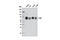 Me2 antibody, 12258S, Cell Signaling Technology, Western Blot image 