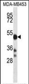 Cytochrome P450 Family 2 Subfamily D Member 6 antibody, PA5-35148, Invitrogen Antibodies, Western Blot image 
