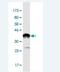 N(Alpha)-Acetyltransferase 15, NatA Auxiliary Subunit antibody, H00080155-M01-100ug, Novus Biologicals, Western Blot image 