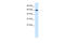 Dachshund Family Transcription Factor 2 antibody, 27-592, ProSci, Western Blot image 