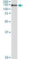 Ubiquitin Specific Peptidase 33 antibody, H00023032-M01, Novus Biologicals, Immunoprecipitation image 