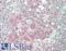 Transcription Factor EB antibody, LS-B14487, Lifespan Biosciences, Immunohistochemistry paraffin image 