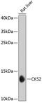 CDC28 Protein Kinase Regulatory Subunit 2 antibody, GTX64839, GeneTex, Western Blot image 