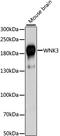 WNK Lysine Deficient Protein Kinase 3 antibody, LS-C750475, Lifespan Biosciences, Western Blot image 